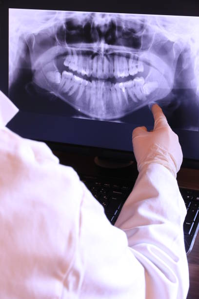 Best Emergency Root Canal Treatment in Woodland Park, CO