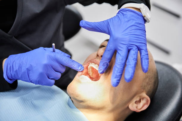 Best Emergency Dentist for Lost Fillings or Crowns in Woodland Park, CO